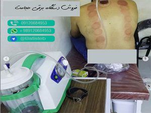 قیمت دستگاه ساکشن برقی حجامت