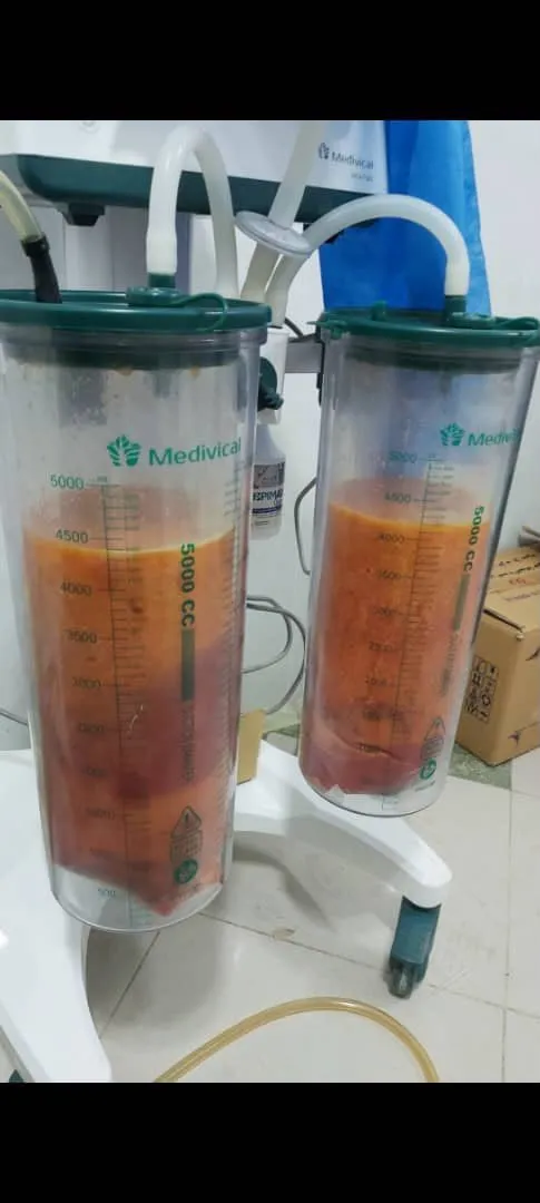 خرید باتل تزریق چربی